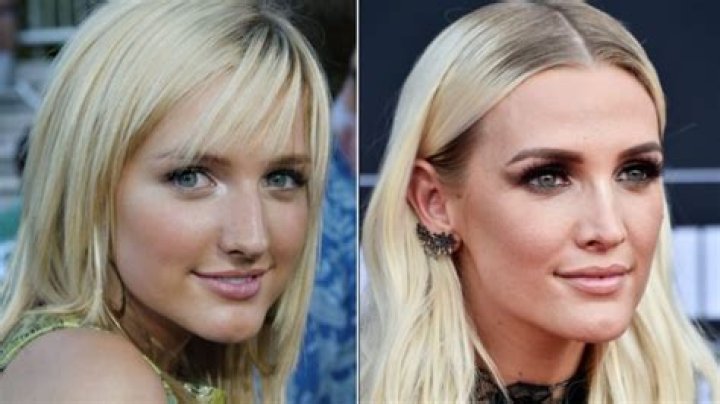 Ashlee Simpson Nose Job Plastic Surgery Before and After