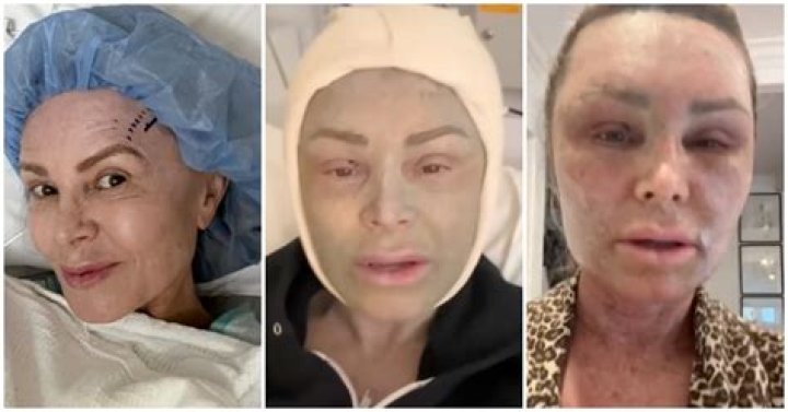 Christopher Judge Plastic Surgery: The Enigma of Transformation!