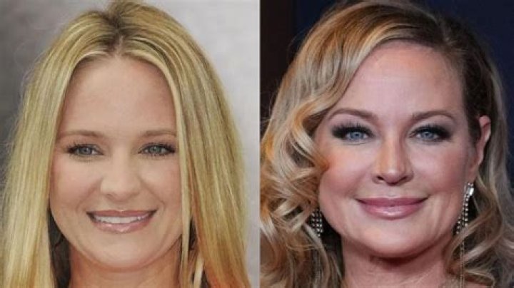 Dana Perino Plastic Surgery: Aging Gracefully or Nipped and Tucked?