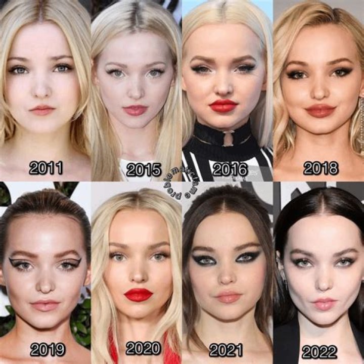 Dove Cameron Plastic Surgery: Cameron's  Barbie Doll Appearance Explored!