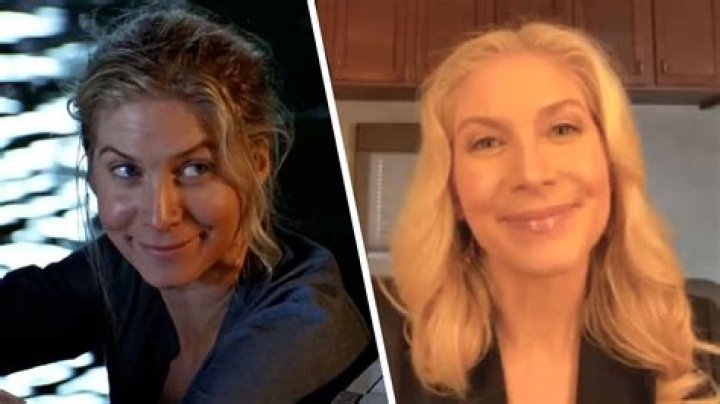 Elizabeth Mitchell Plastic Surgery Before and After