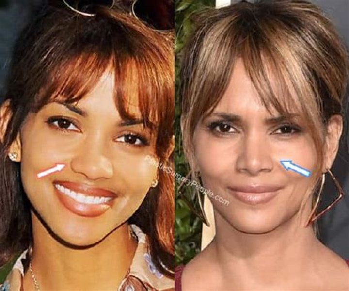 Halle Berry Breast Implants Plastic Surgery Before and After