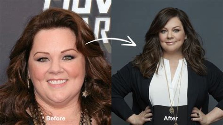 Jenny McCarthy Plastic Surgery: The Truth About Her Cosmetic Enhancements