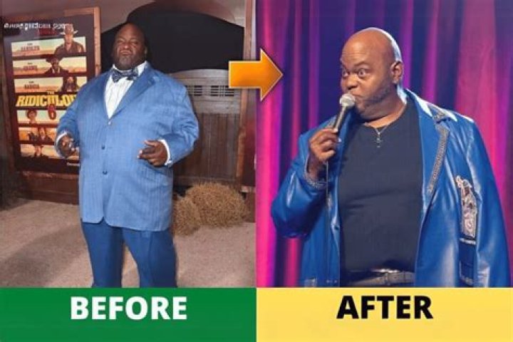 Lavell Crawford Weight Loss: From His Diet and Workout to Weight Loss Surgery!