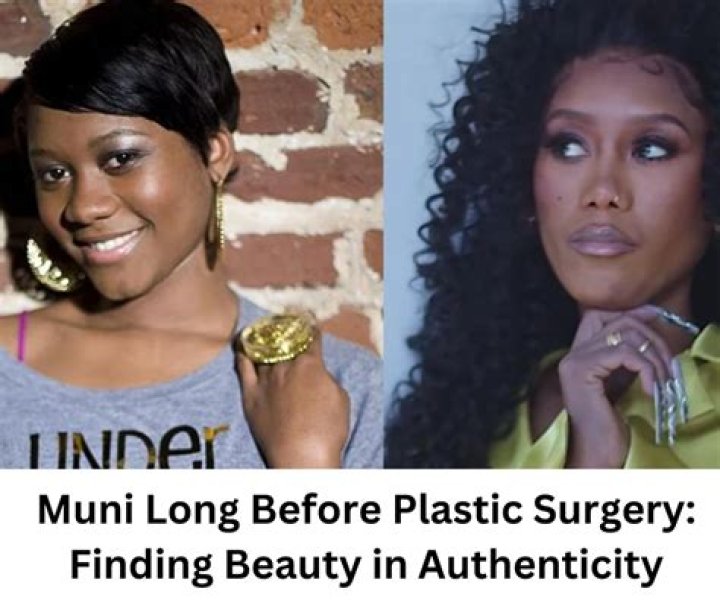 Muni Long Plastic Surgery: Apparent Changes in Muni Long's Look and Anticipated Procedures!