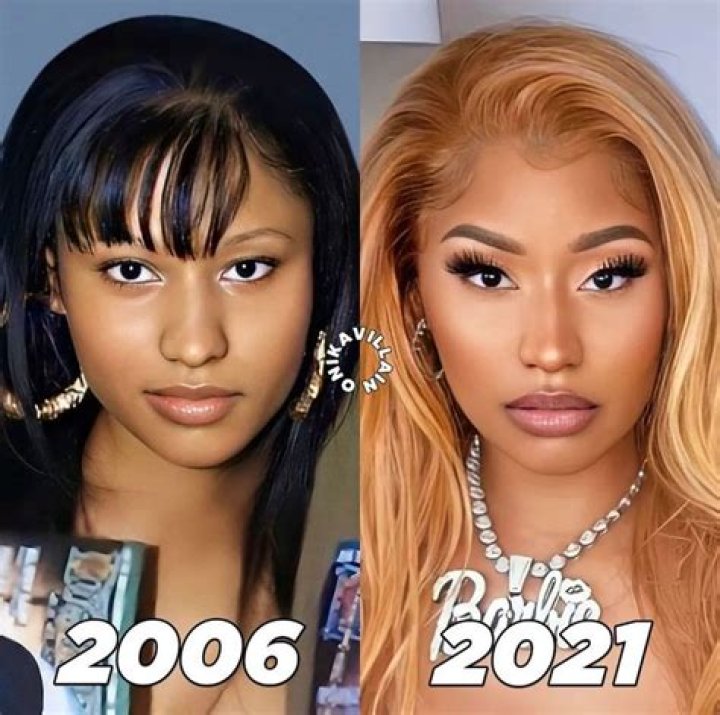 Nicki Minaj Before and After: The Art of Reinvention!