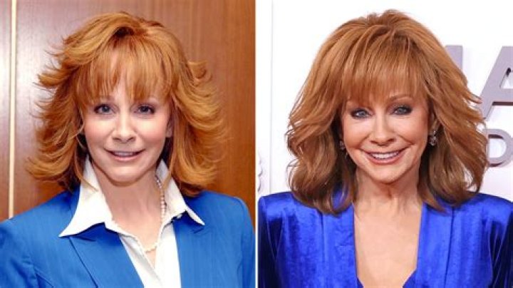 Reba McEntire Facelift Plastic Surgery Before and After