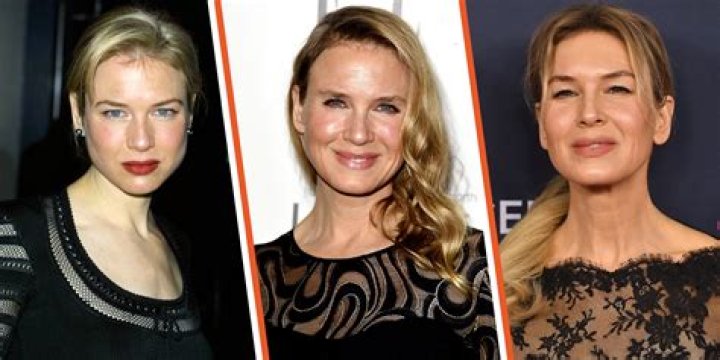 Renee Zellweger Plastic Surgery: Exploring the Truth Behind the Celebrity Facelift Speculation